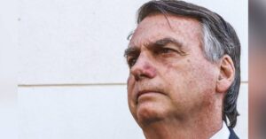 carcinoma-de-celulas-escamosas:-entenda-cancer-de-bolsonaro