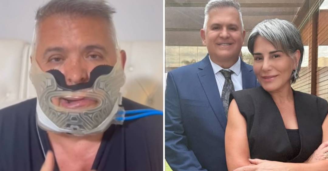 o-motivo-da-cirurgia-no-rosto-de-orlando-morais,-marido-de-gloria-pires